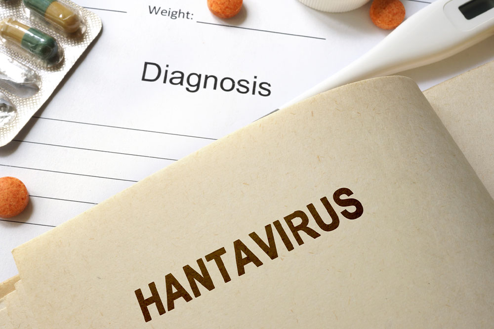 Hantavirus pulmonary syndrome &#8211; Signs, causes, and more