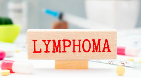 B-cell lymphoma &#8211; Causes, signs, and more