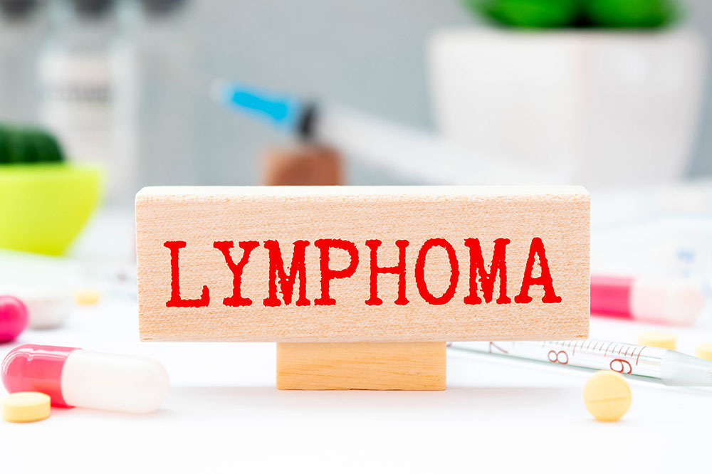 B-cell lymphoma &#8211; Causes, signs, and more