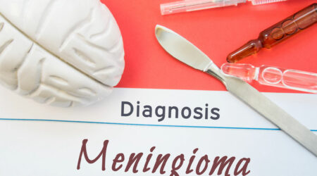 Meningioma &#8211; Signs, causes, and management