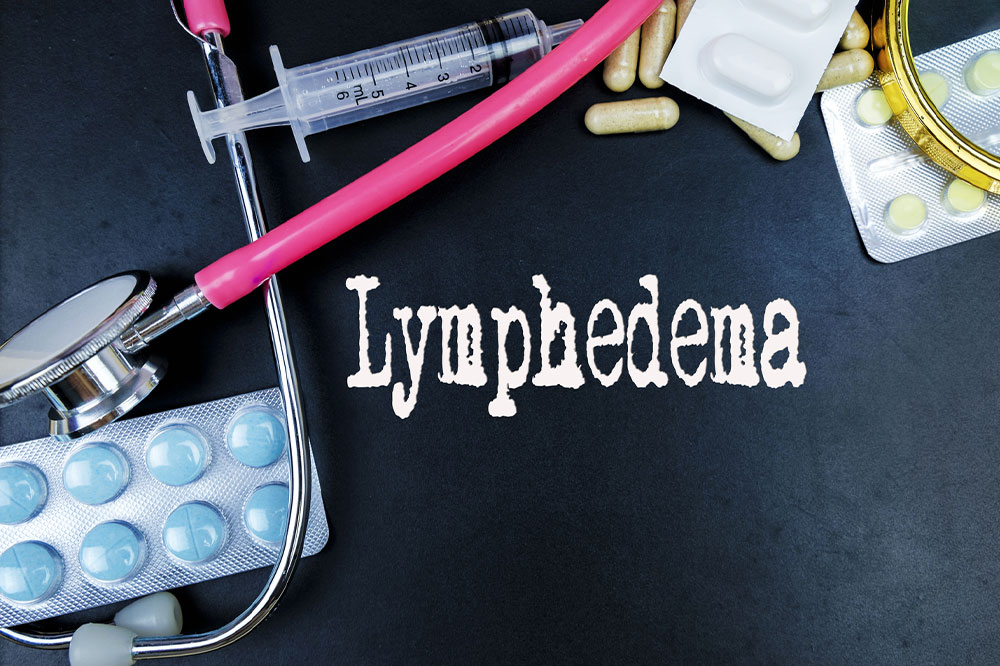 Lymphedema &#8211; Causes, signs, and management