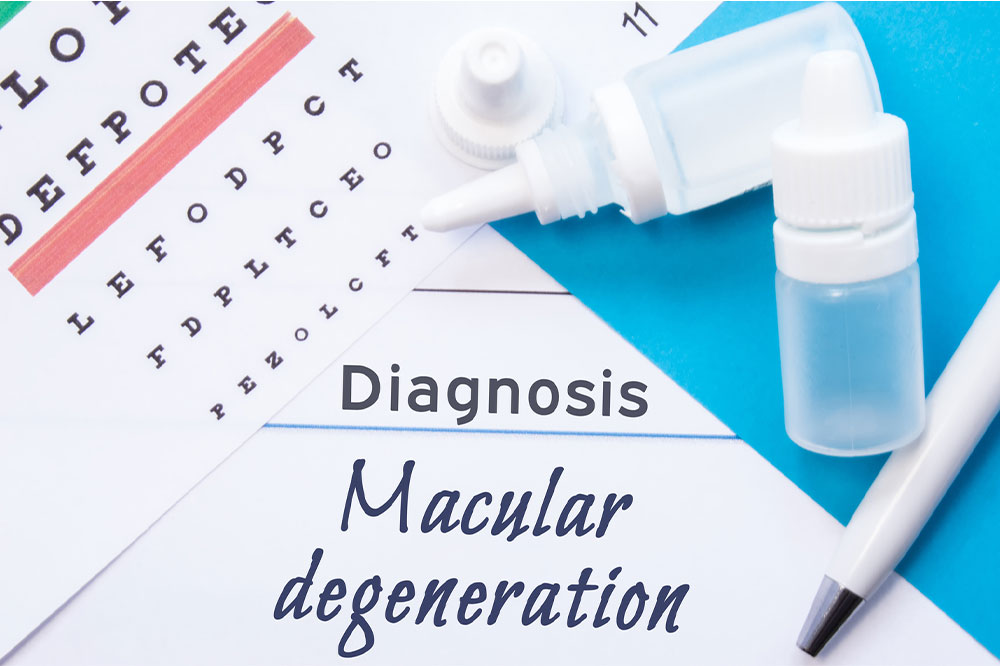 A brief understanding of age-related macular degeneration