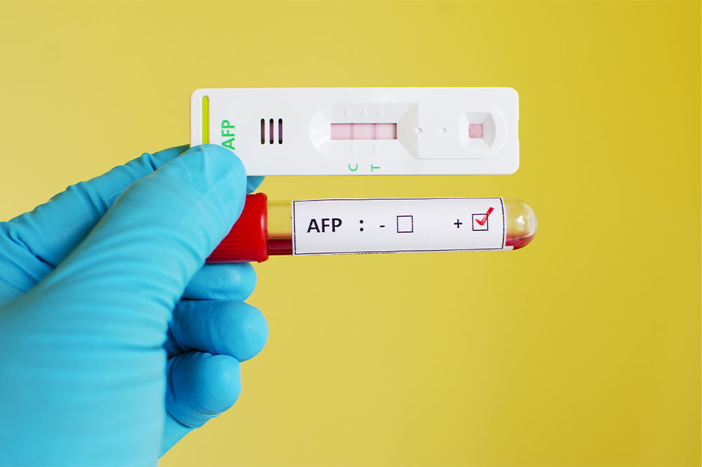 What is an alpha-fetoprotein test