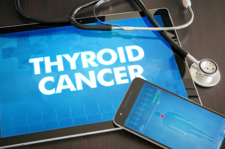 Thyroid cancer – Symptoms, types, and management options